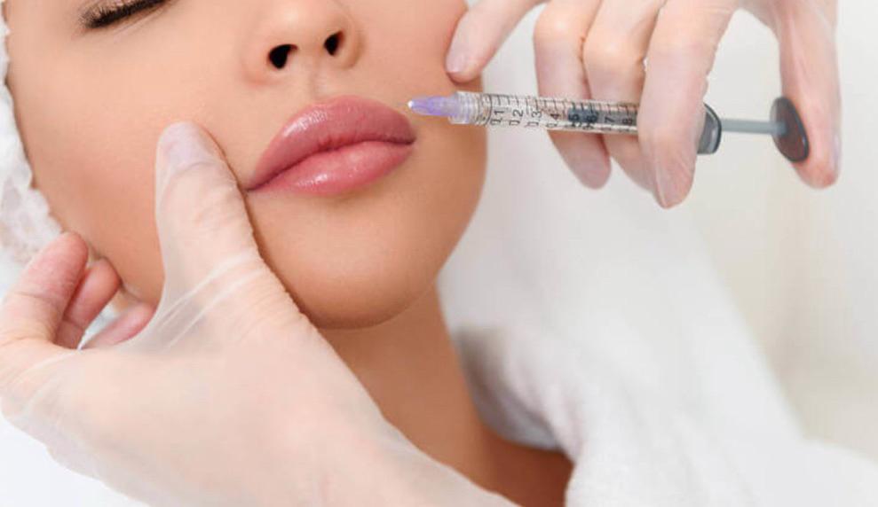 tratamento de Preenchimento Labial
